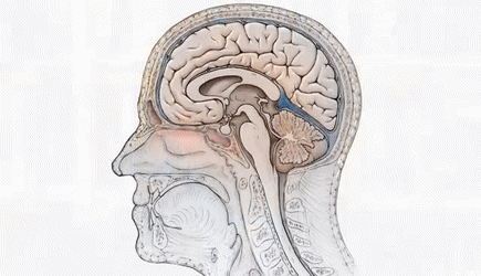 垂体瘤在头部位置图片图片