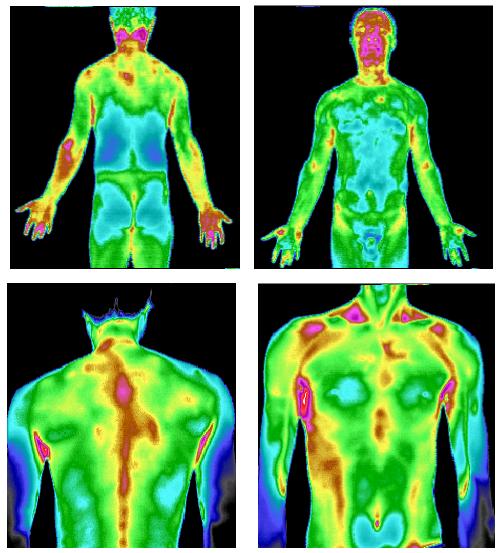 人体温度红外线图图片