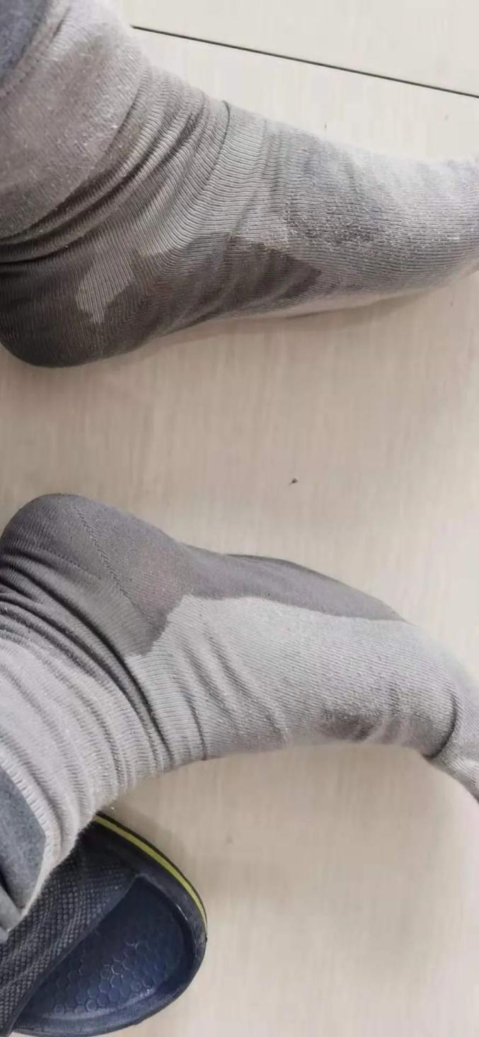 这位同志,鞋底都掉了