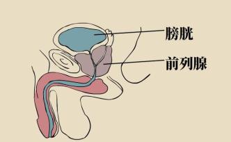 预防这种“慢热型”癌，男人们要做好六件事