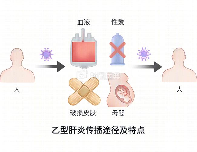 丙肝传播途径图片