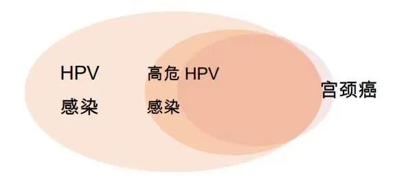 大家都知道,hpv感染是宫颈癌的罪魁祸首