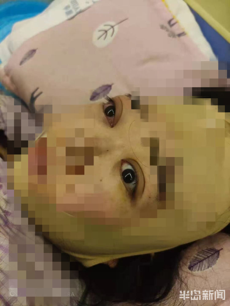 青岛一女子抽脂手术后眼部不适 华颜美医疗美容医院这样回复(图3)