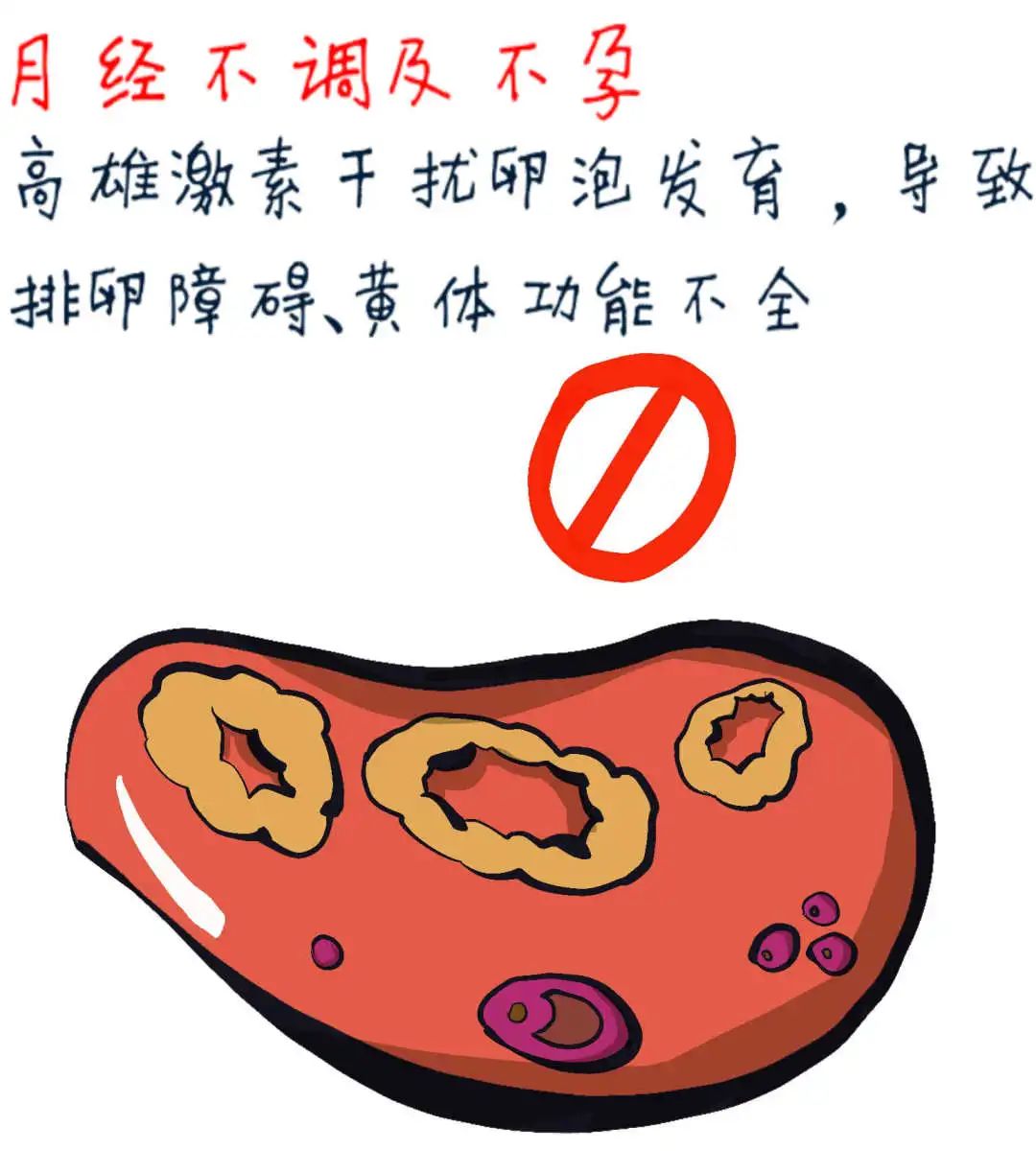 女查雄激素挂什么科（女性去医院检查雄激素挂什么科） 女查雄激素挂什么科（女性去医院查抄
雄激素挂什么科）《女性查雄激素应该挂什么科》 女科知识