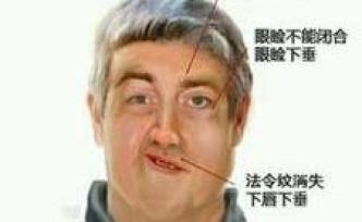 眼皮跳是面肌痙攣嗎？