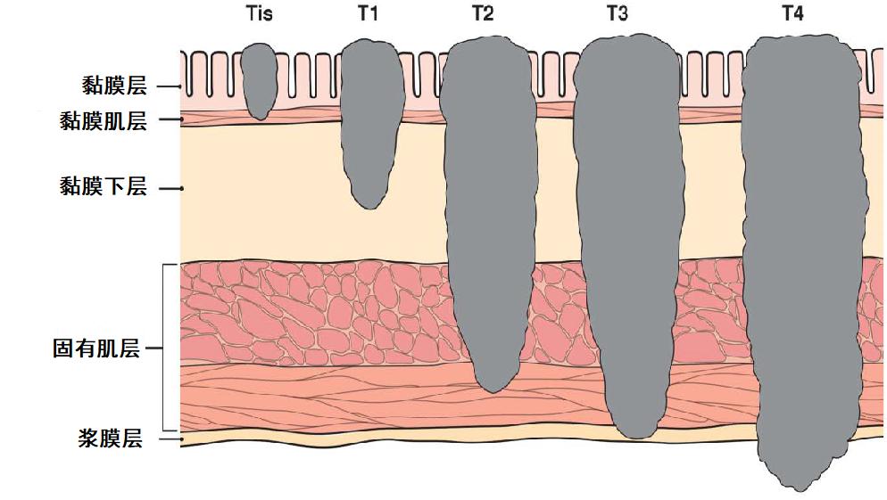 直肠分层5层示意图图片