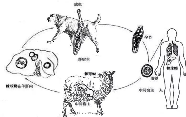 28歲小夥肝臟巨大囊腫 滿是寄生蟲卵