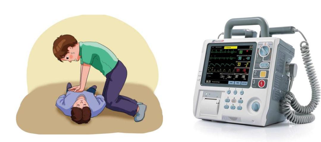 电除颤位置图片图片