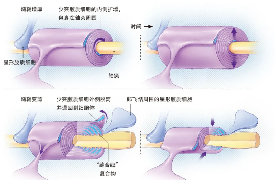 学霸和学渣的大脑有什么不同