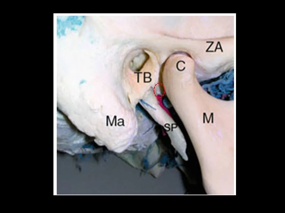 神经外科学习:征途与跨越(四)