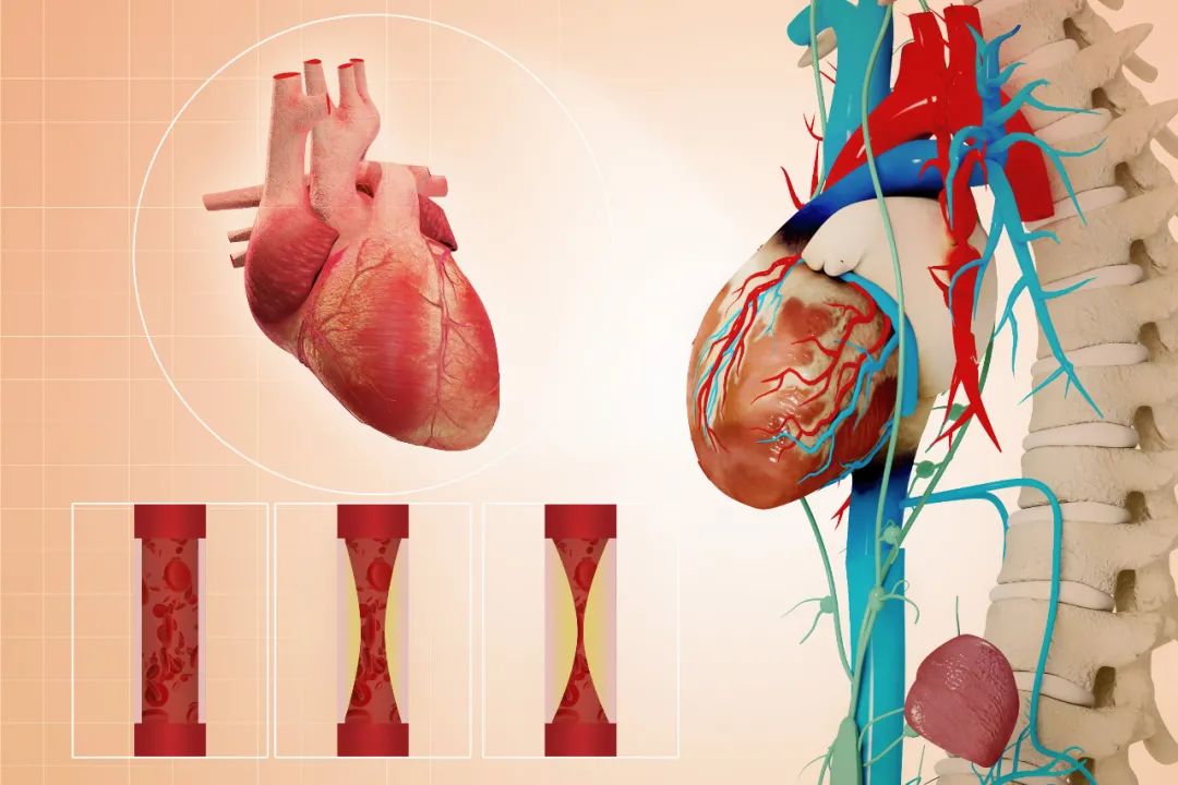血脂维持在什么水平既能保证机体正常心脑血管事件发生率又最低