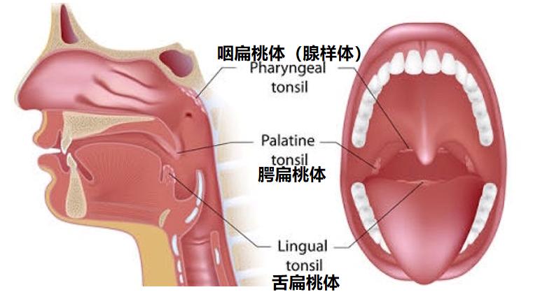 嗓子红 嗓子痛 嗓子化脓 是细菌还是病毒感染