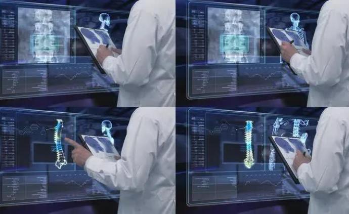 可自检的X光设备，减少就医成本随时检查骨骼