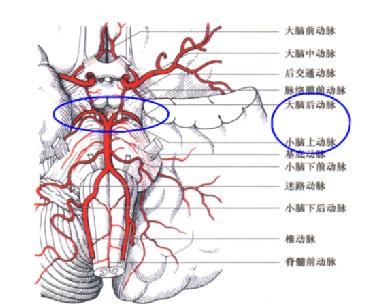 圖3a圖3b圖3c圖3 a大腦腳血供底面觀 b大腦腳血供側面觀 c大腦腳血供