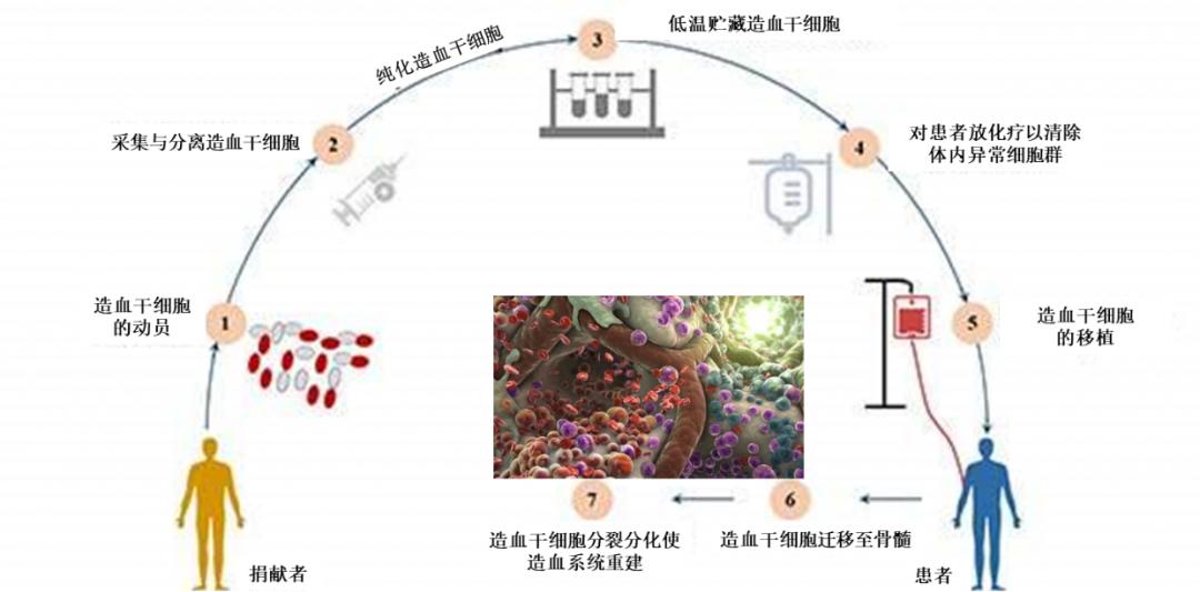 造血干细胞移植疗法步骤问题3:造血干细胞移植疗法的瓶颈与出口何在?