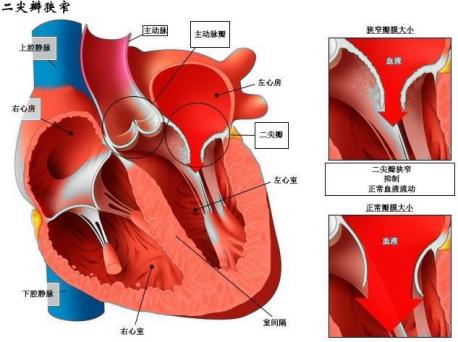心脏瓣膜位置解剖图图片
