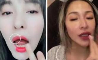 “催吐管”減肥——摧折你的美