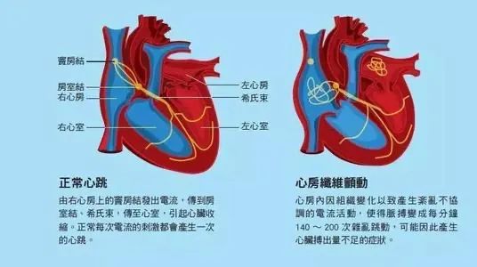 曙光科普窦性心律是什么过缓过速不齐要紧吗