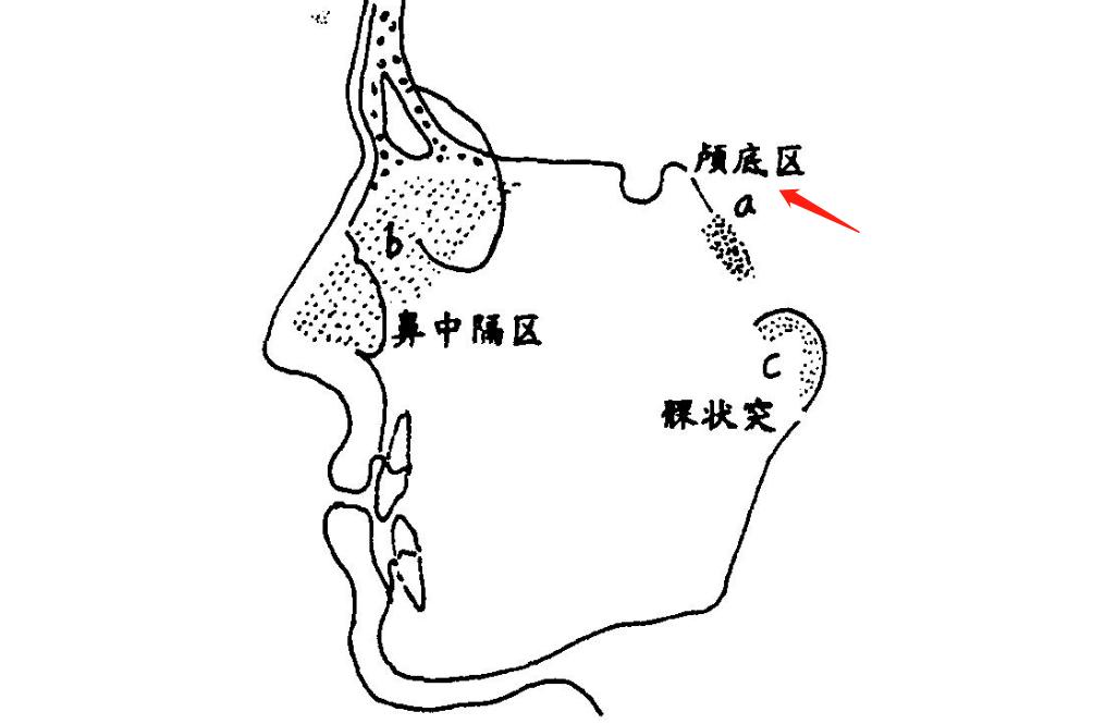 天灵盖位置图图片