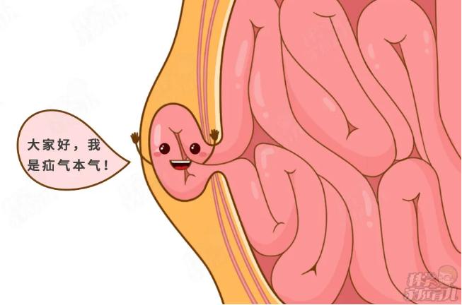 图片来源:科学家庭育儿原创如果疝气发生在腹股沟,就称为"腹股沟疝气"