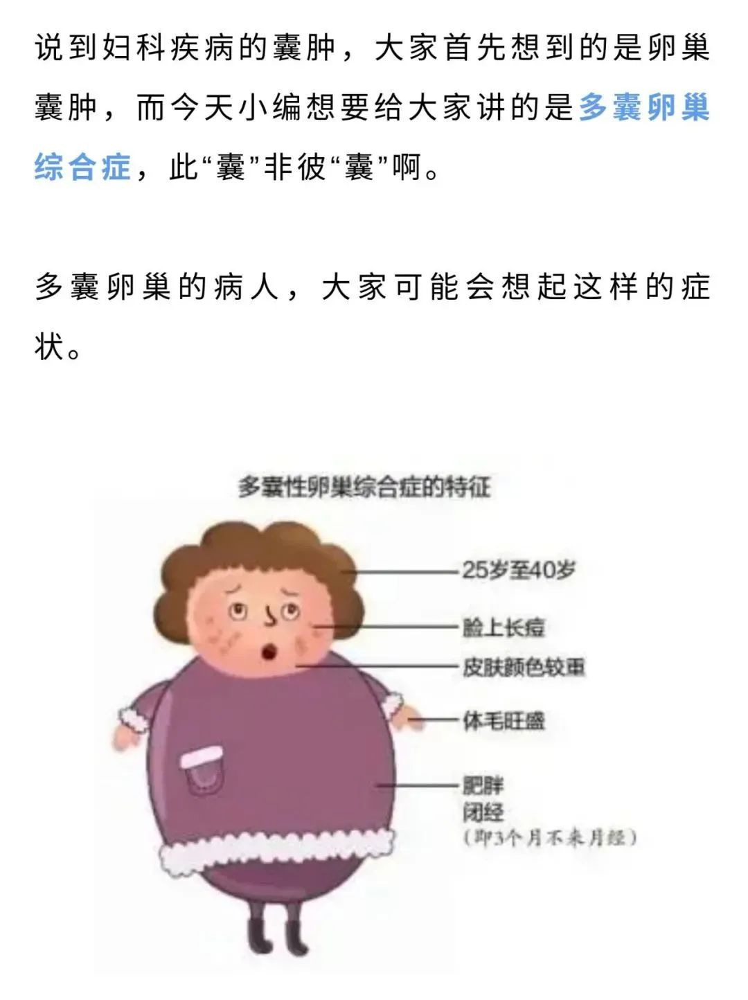 肥胖闭经不孕可能是多囊在嚯嚯你