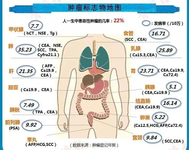 【邮医67体检须知(十)】教你看懂体检报告中的肿瘤标志物