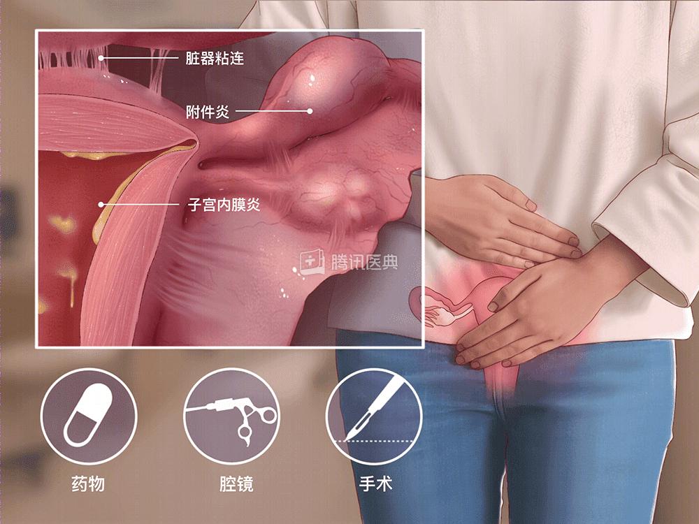 子宫在腹部的位置图片