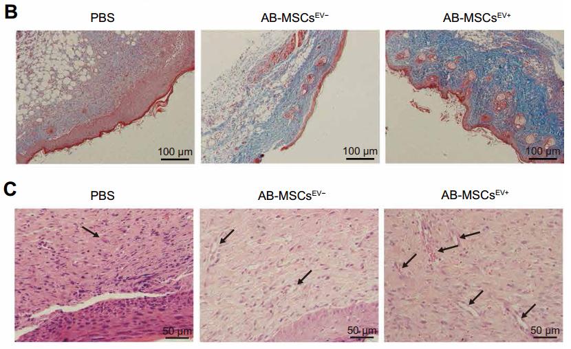 《科学》子刊:脐带血中真有"年轻因子"