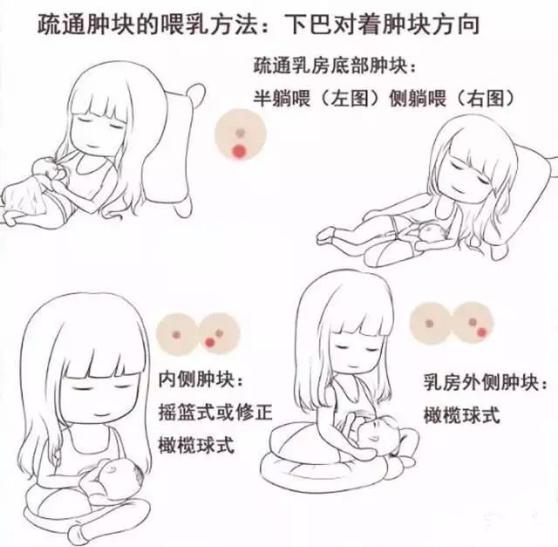 「苗家惠嫂微课堂」乳汁淤积别担心