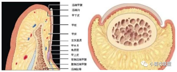 甲沟炎如何自己处理（甲沟炎如何自己处理及如何预防）-85模板网