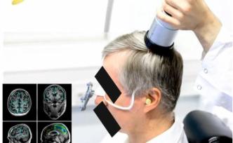 超声波在脑部疾病治疗中的应用