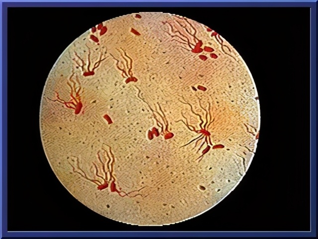 伤寒杆菌油镜观察图片图片