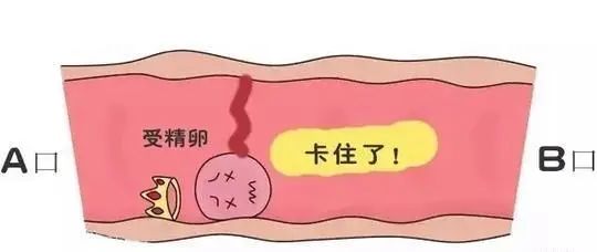 04卵巢過度刺激綜合症卵巢過度刺激綜合症是非常兇險的,而且發病率極