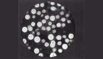 新型隐球菌负染色法图片