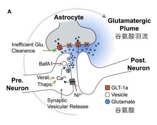 偏头痛时 大脑里竟有一场 微型海啸 湃客 澎湃新闻 The Paper