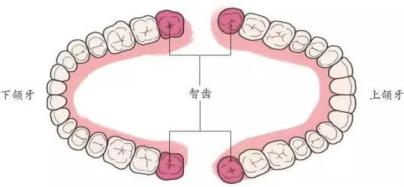 一般从正中的门牙往里数,数到了第八颗牙齿:恭喜你,是被智齿宠爱的