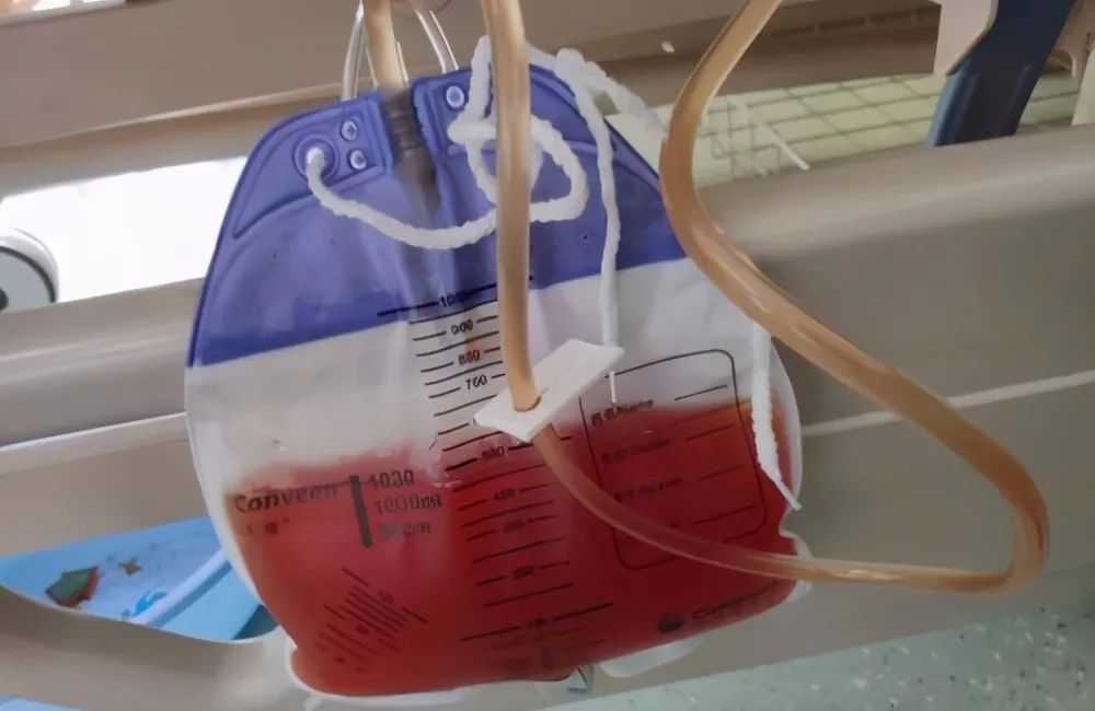 肺癌患者为什么会出现胸腔积液癌细胞会吐水吗