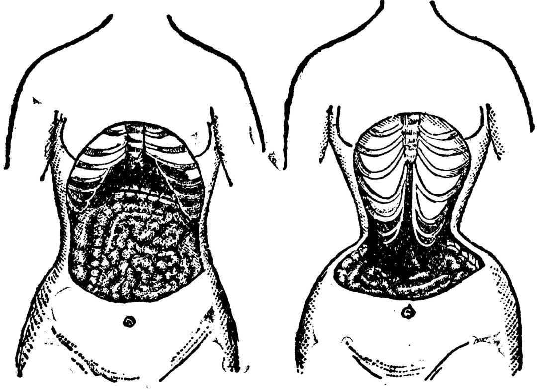 束腰危害图片