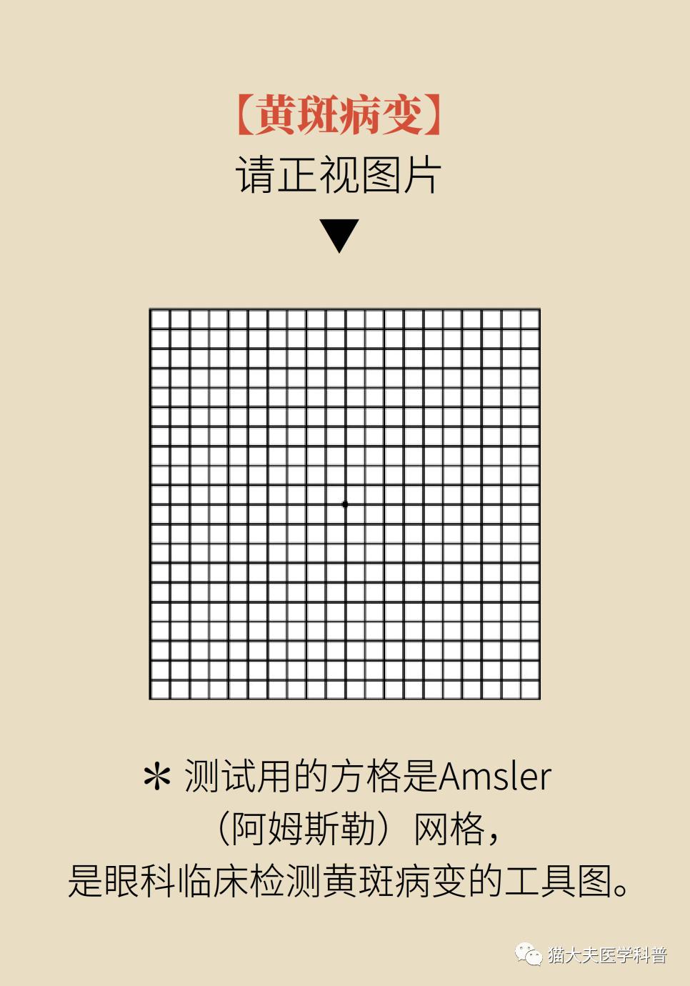 白内障自测图年轻人图片