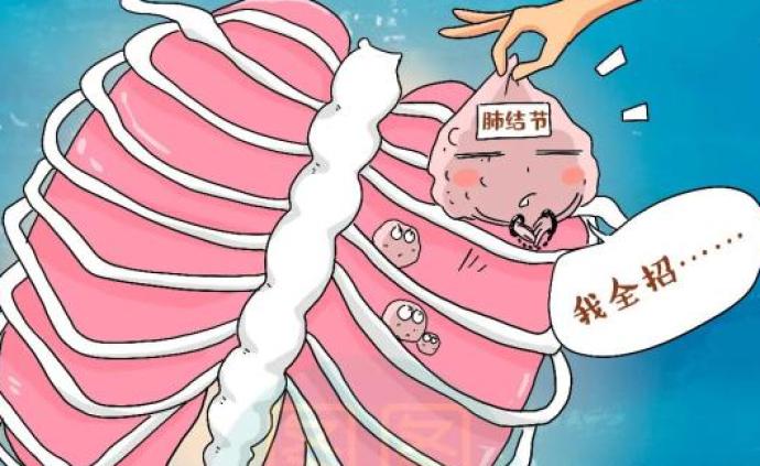 体检发现肺结节,是不是得了肺癌?