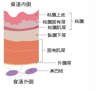 食管壁分层图片