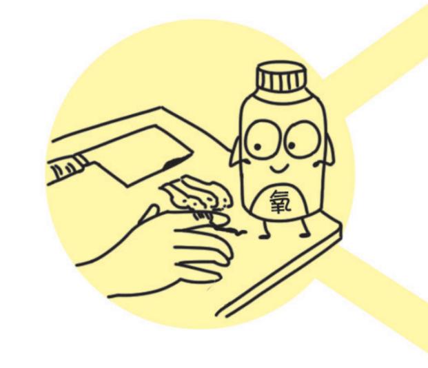 碘酒:消毒皮肤后,要用75%酒精进行脱碘,否则会烧伤皮肤.