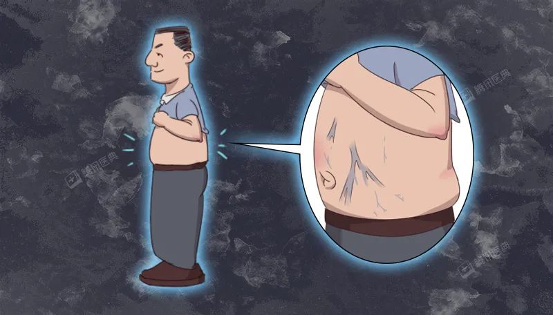 这3个部位青筋暴起可能是身体的求救信号