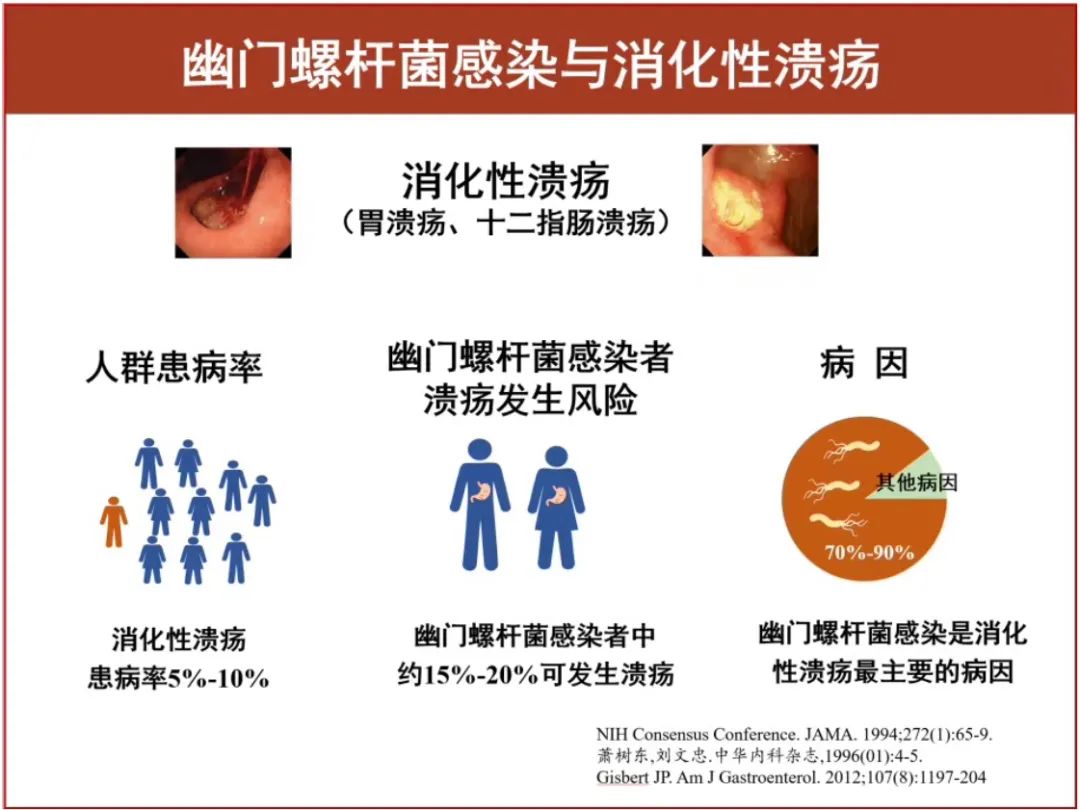 消化性溃疡病因图片