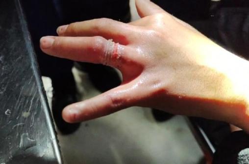 手手敏感,娇嫩,易受伤请让它们远离缝隙,利刃等一切危险!