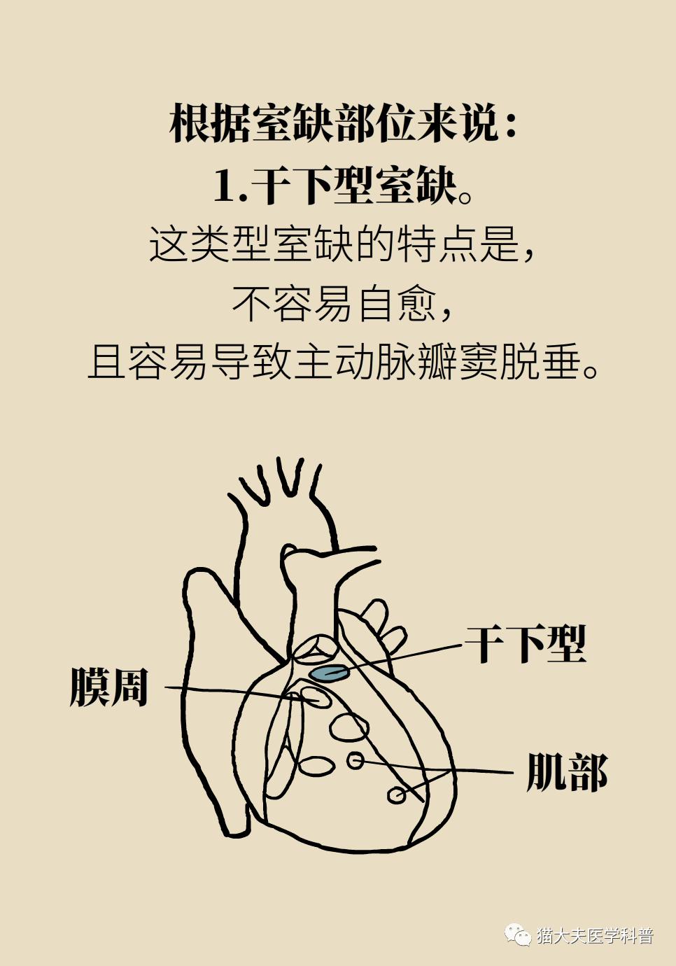 别忙着给娃儿手术能自愈的心脏室缺它不香吗