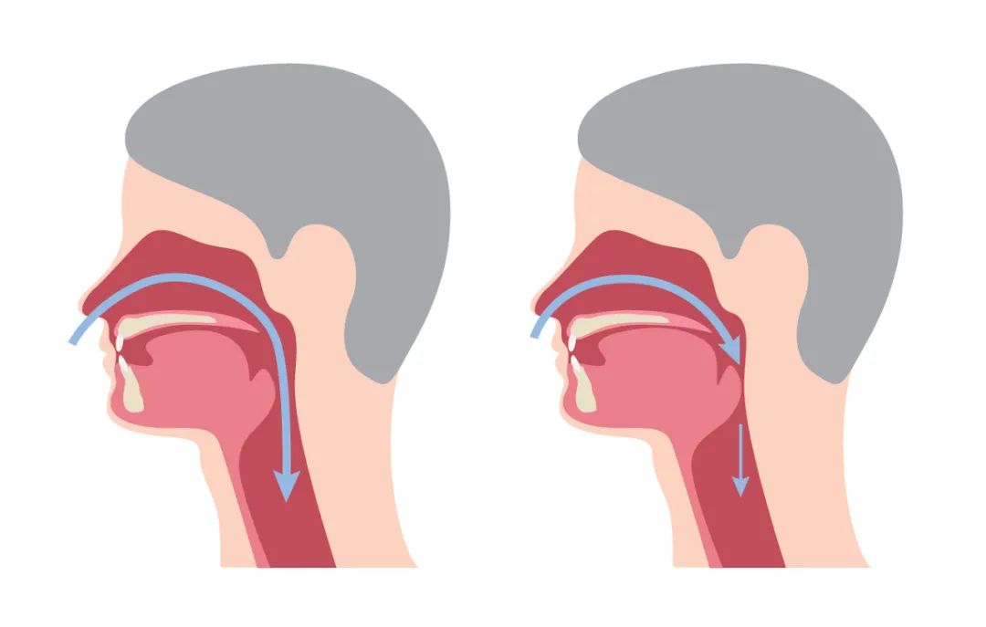 呼噜声隐藏的致命信号你能分辨吗