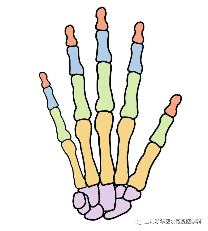 掌骨骨折的作业治疗