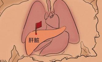 4个最伤肝的行为，第2个你可能天天都在做丨全国爱肝日