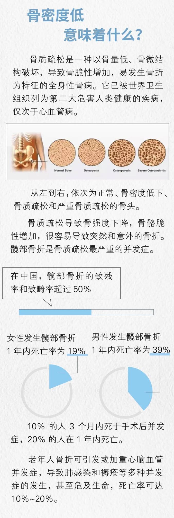 骨质疏松正悄无声息地进行！5个迹象表明骨量减少